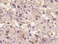 phospho-CK18 (Ser52) Rabbit pAb