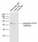 phospho-CK18 (Ser52) Rabbit pAb