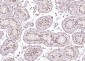 Retinoic acid induced 17 Rabbit pAb