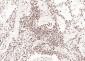 ERCC1 Recombinant Rabbit mAb