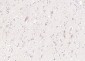 LIFR Rabbit pAb