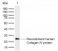 Collagen IV Rabbit pAb