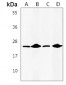 Anti-IL-24 Antibody