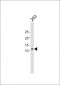 Phospho-PLM(S68) Antibody