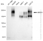 KD-Validated Anti-ABCB1 Rabbit Monoclonal Antibody