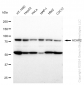 KD-Validated Anti-ACAP2 Rabbit Monoclonal Antibody