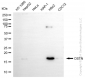 KD-Validated Anti-DSTN Rabbit Monoclonal Antibody