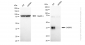 KD-Validated Anti-C4BPB Rabbit Monoclonal Antibody