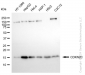 KD-Validated Anti-CDKN2C Rabbit Monoclonal Antibody