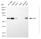 KD-Validated Anti-LGI1 Rabbit Monoclonal Antibody