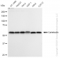 KD-Validated Anti-Calreticulin Rabbit Monoclonal Antibody