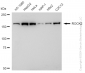 KD-Validated Anti-ROCK2 Rabbit Monoclonal Antibody