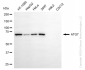 KD-Validated Anti-ATG7 Rabbit Monoclonal Antibody