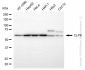 KD-Validated Anti-CLPX Rabbit Monoclonal Antibody