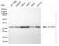 KD-Validated Anti-GTF2F2 Rabbit Monoclonal Antibody