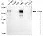 KD-Validated Anti-MERTK Rabbit Monoclonal Antibody