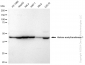 KD-Validated Anti-Histone acetyltransferase 1 Rabbit Monoclonal Antibody