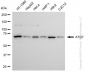 KD-Validated Anti-ATG7 Rabbit Monoclonal Antibody