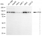 KD-Validated Anti-IFIH1 Rabbit Monoclonal Antibody