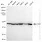 KD-Validated Anti-IDH1 Rabbit Monoclonal Antibody