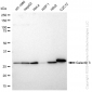 KD-Validated Anti-Galectin 3 Rabbit Monoclonal Antibody