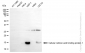 KD-Validated Anti-CRABP1 Rabbit Monoclonal Antibody