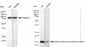KD-Validated Anti-CRABP1 Rabbit Monoclonal Antibody