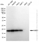 KD-Validated Anti-NME1 Rabbit Monoclonal Antibody