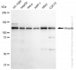 KD-Validated Anti-Vinculin Rabbit Monoclonal Antibody