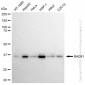 KD-Validated Anti-RAD51 Rabbit Monoclonal Antibody