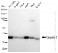 KD-Validated Anti-Caspase 3 Rabbit Monoclonal Antibody