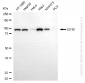 KD-Validated Anti-Membrane Metalloendopeptidase Rabbit Monoclonal Antibody