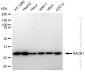 KD-Validated Anti-RACK1 Rabbit Monoclonal Antibody