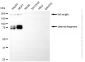 KD Validated Anti-L1 cell adhesion molecule Rabbit Monoclonal Antibody