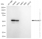 KD-Validated Anti-Keratin 7 Rabbit Monoclonal Antibody