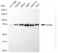 KD-Validated Anti-FURIN Rabbit Monoclonal Antibody