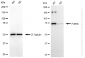 KD-Validated Anti-FURIN Rabbit Monoclonal Antibody