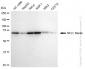 KD-Validated Anti-NF2 / Merlin Rabbit Monoclonal Antibody