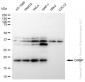 KD-Validated Anti-CIRBP Rabbit Monoclonal Antibody