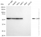 KD-Validated Anti-CAP1 Rabbit Monoclonal Antibody