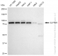 KD-Validated Anti-CLPTM1 Rabbit Monoclonal Antibody