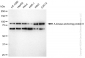 KD-Validated Anti-A-kinase anchoring protein 8 Rabbit Monoclonal Antibody