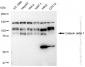 KD-Validated Anti-Catenin delta 1 Rabbit Monoclonal Antibody