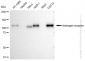 KD-Validated Anti-Androgen receptor Rabbit Monoclonal Antibody