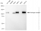 KD-Validated Anti-Androgen receptor Rabbit Monoclonal Antibody