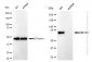 KD-Validated Anti-ABCD1 Rabbit Monoclonal Antibody