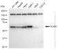 KD-Validated Anti-ALAS1 Rabbit Monoclonal Antibody