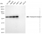 KD-Validated Anti-Checkpoint kinase 2 Rabbit Monoclonal Antibody