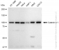 KD-Validated Anti-Catenin alpha 1 Rabbit Monoclonal Antibody
