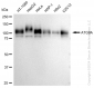 KD-Validated Anti-ATG9A Rabbit Monoclonal Antibody